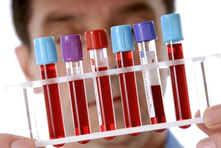 Blood tests for the diagnosis of helminthiasis