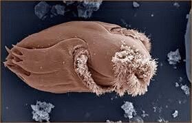 Pathogenic microorganisms in humans
