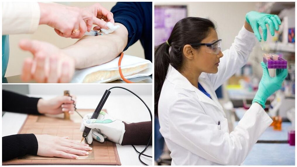 Diagnostic methods for detecting parasites in the body.