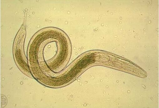intestinal worm