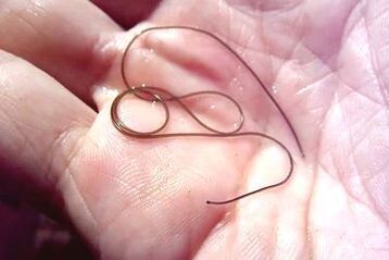 worm parasite of the human body