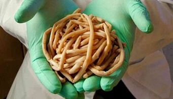 Body parasites elimination methods
