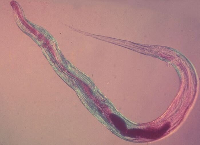 Pinworms under a microscope