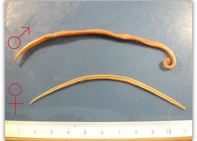Size of roundworms worms that infect the respiratory tract of adults.